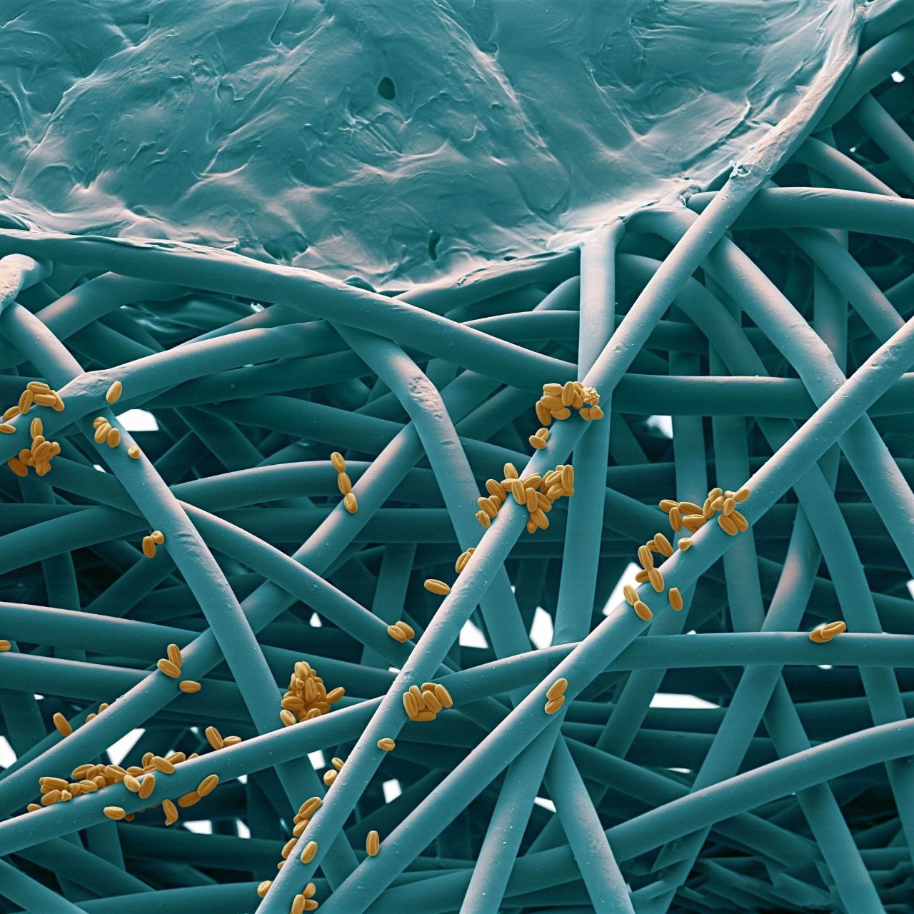 Пыльца коронавирус под микроскопом