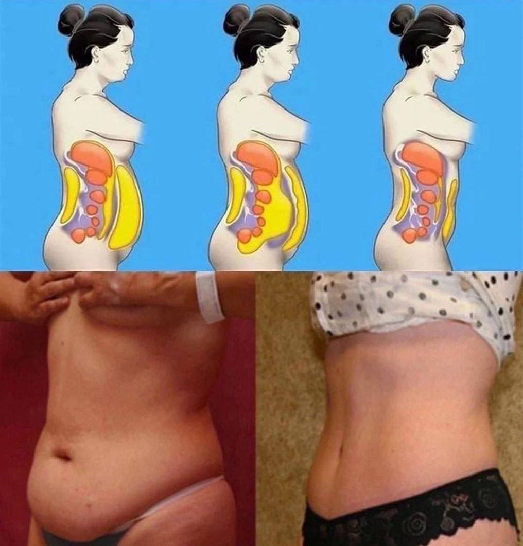 Висцеральный жир у мужчин как убрать живот в домашних условиях Висцеральный жир у мужчин как убрать живот в домашних условиях